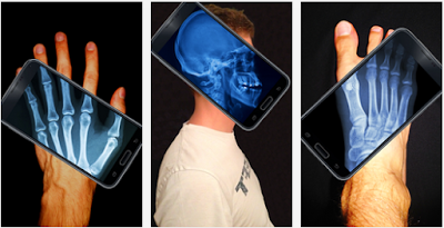 Xray Scanner Camera