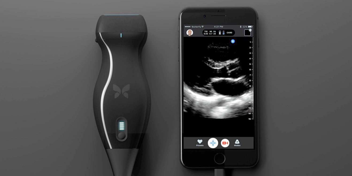 Ternyata iPhone Dan Aksesori Butterfly IQ Bisa Deteksi Kanker Di Dalam Tubuh